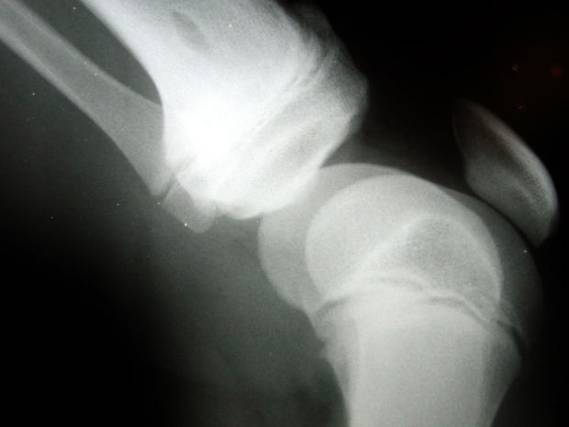 Huesos, radiografia